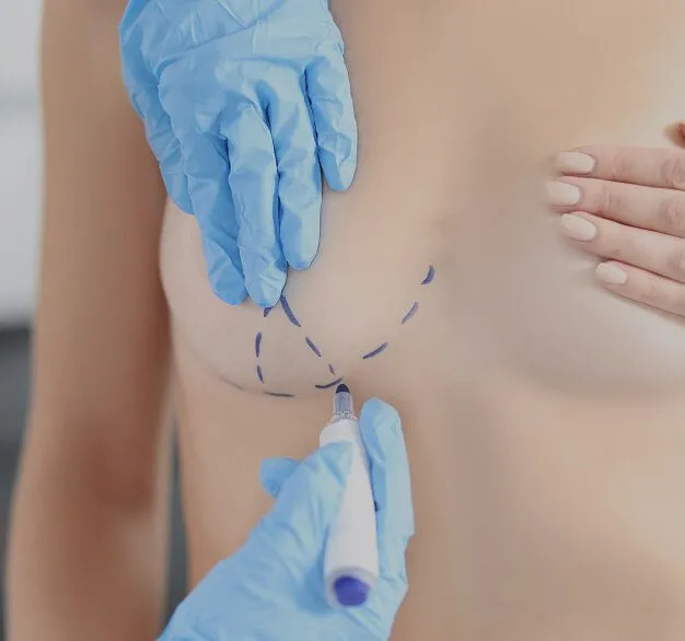Why choose Breast Augmentation